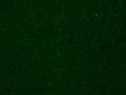 CYBB/NOX2 Antibody - BSA Free, Novus Biologicals:Antibodies:Primary Antibodies
